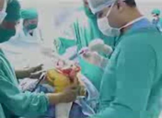 Elbow Replacement In India, Gujarat, Ahmedabad, Rajasthan