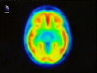 LSD: Experimentos militares (La risa cosmica)