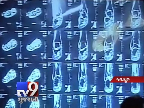 Doctor successfully performs surgery with help of Google Glass, Jaipur - Tv9 Gujarati