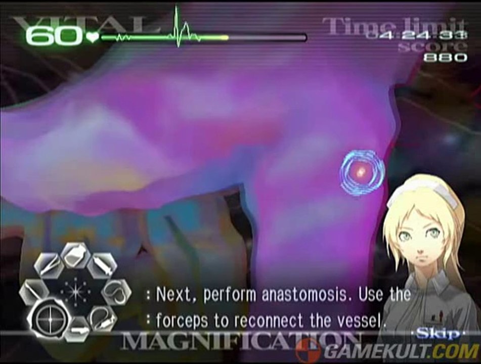 Trauma Center : Second Opinion - Manque de temps