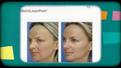 Multiple Wavelengths In Laser Hair Removal_(360p)