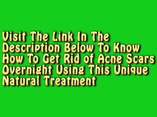 How To Get Rid of Acne Scars Overnight