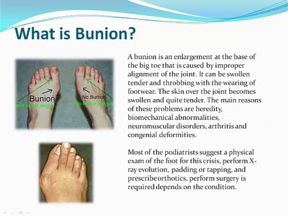 Dr. Kevin Lam Reviews and Treatment Options for Ankle Injuries