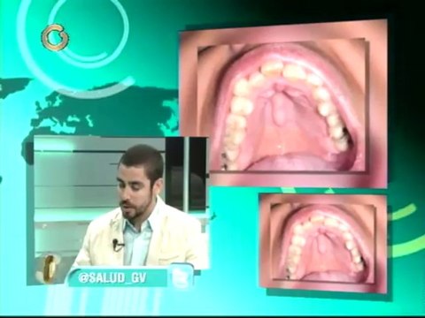 Conozca el diagnóstico y pronóstico de quistes y tumores maxilares