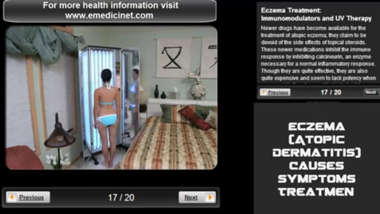 Eczema Atopic Dermatitis Causes, Symptoms and Treatment Pictures Slideshow -1280x720