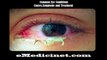 Common Eye Diseases and Conditions causes,symptoms,diagnosis and treatment part 1 -480x360