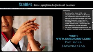 Scabies Causes,symptoms,diagnosis and treatment part 1 -1280x720