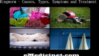 Ringworm - Causes, Types, Symptoms and Treatment - By eMedicinet.com - Part 2