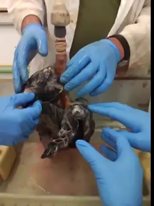 Poumons sains vs Poumons de fumeur