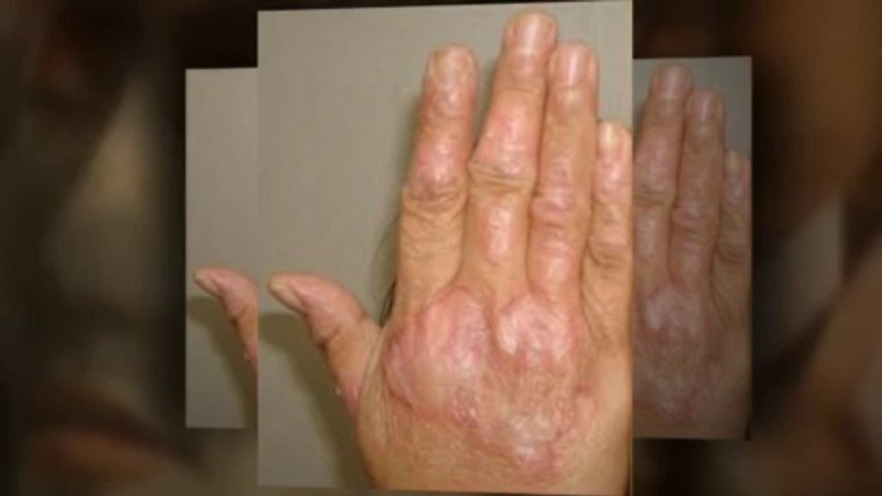 Skin Problems