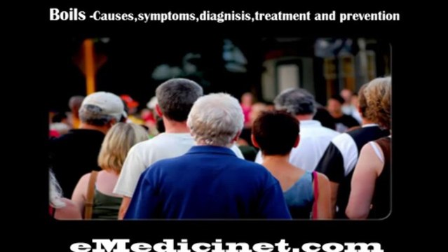 Boils -Causes,symptoms,diagnosis,treatment and prevention