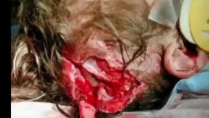 OGRE - Brain Driller