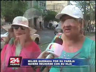 Mujer quemada por su pareja recibe ayuda del Ministerio de la Mujer