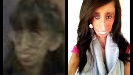 It Gets Better: Lizzie Velasquez