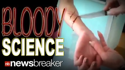 CLASSROOM CUTTING: Teacher Uses Science To Cut A Student's Arm