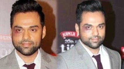 Abhay Deol Beaten By T Series - CHECKOUT