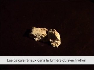Les calculs rénaux dans la lumière du synchrotron