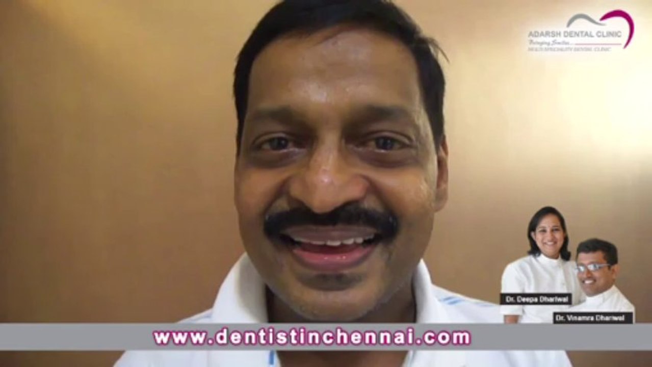 Porcelain Veneers India | Best Dentist in Chennai