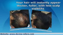 Hair Building Fiber in Pakistan Call 03009533102