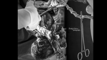 Doğum Hikayesi | Bengisu Bektaş | 13.01.2014