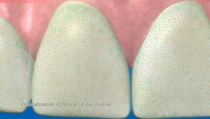 NEW Crest White strips Advanced Seal - How It Works