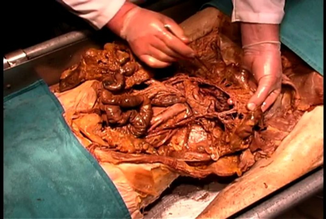 Dissection07