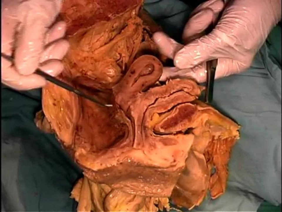 Dissection09