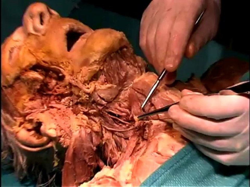 Dissection13