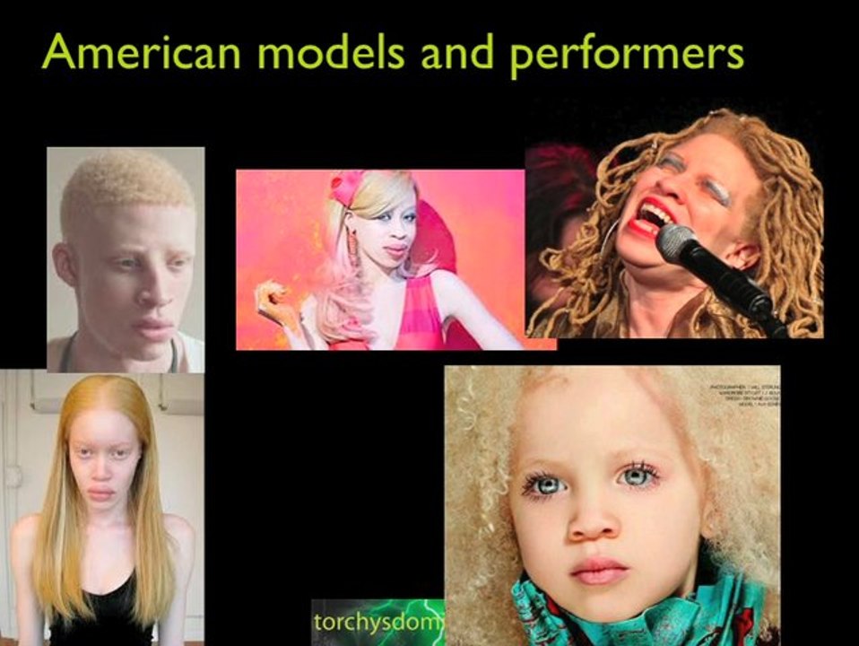 Noah was a black albino