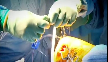 Πόσο κοστολογούν το πτώμα μας οι αλήτες! _ (Documentary)