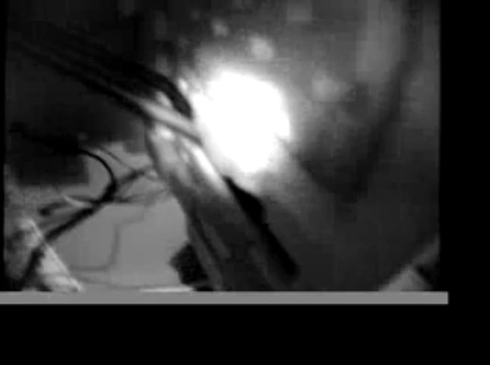 iSamsterIVteaser