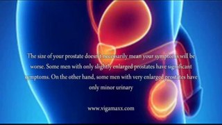 BPH Enlarged Prostate Symptoms, What Are BPH Enlarged Prostate Symptoms That You Should Know!