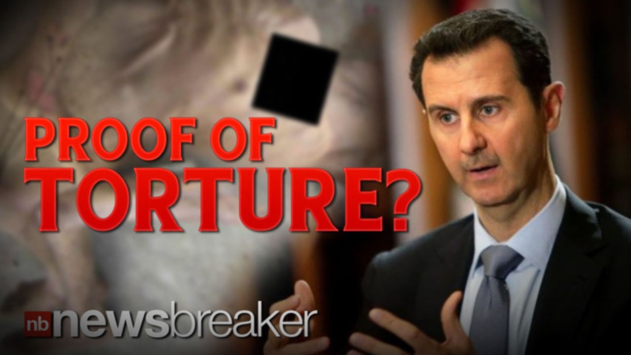 PROOF OF TORTURE?: Shocking Photos May Prove Gruesome Abuse at Hand of Assad