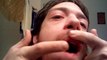 Video - I popped a small zit on my upper lip that I thought exploded all over the mirror, hitting my right finger instead