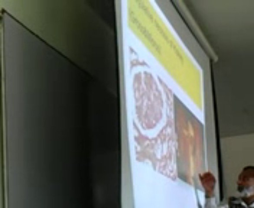 Coagulative Necrosis: Lecture by Dr. Ahmad Din Anjum