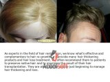 Finding the right hair transplant doctor lace wig,hair loss,wigs,hair replacement system