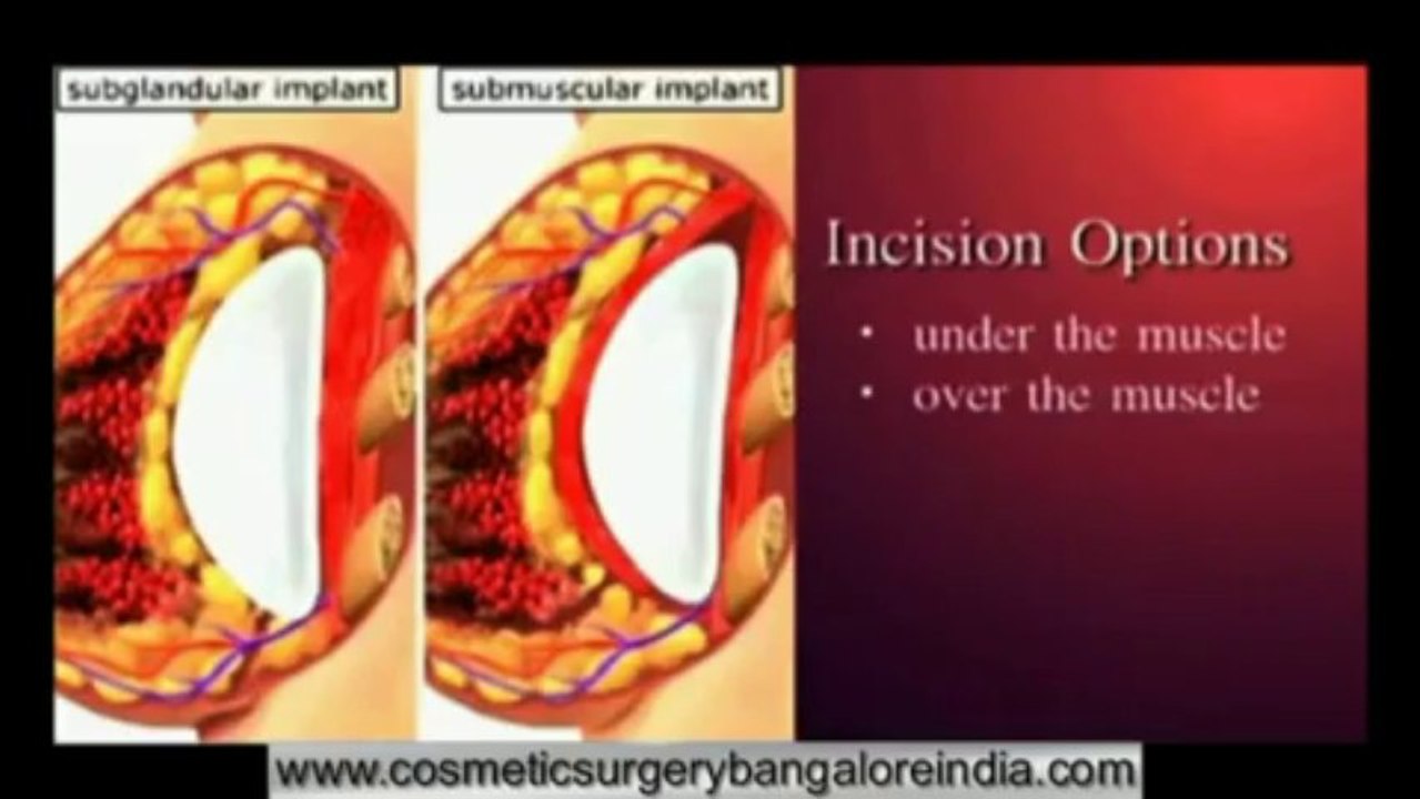 Cosmetic Surgery bangalore ,India:"The Image in the Mirror"