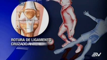 Falcao será operado mañana