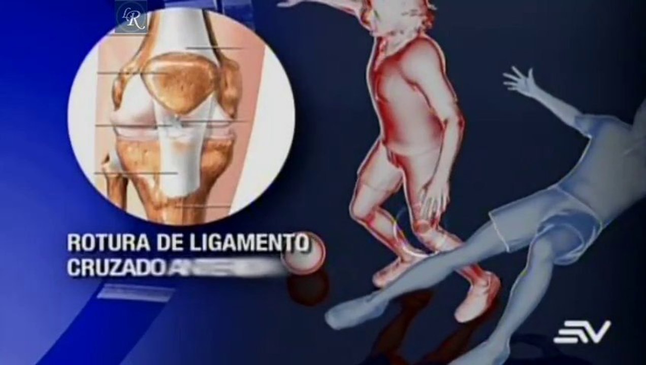 Falcao será operado mañana