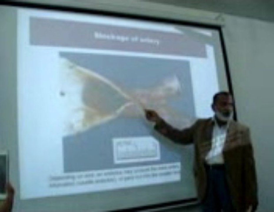 Embolism Part 1: Lecture by Dr. Ahmad Din Anjum (Pathology)