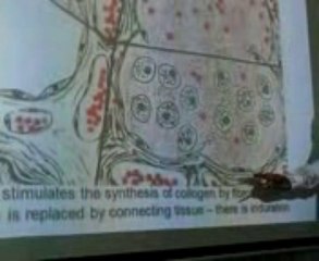 Heamosidrin: Lecture by Dr. Ahmad Din Anjum (Pathology)