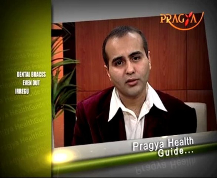 Dental braces are a type of orthodontic treatment used to correct teeth