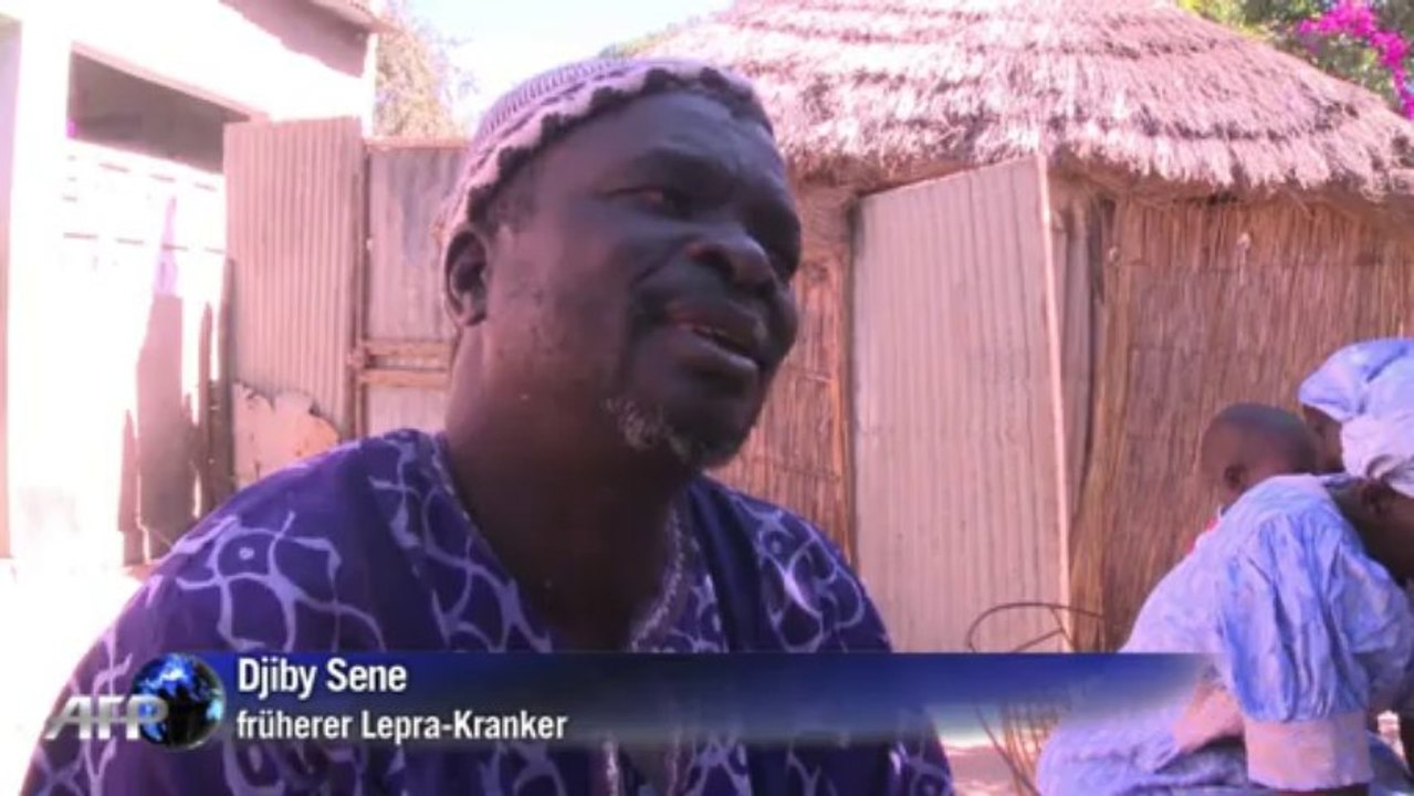 Einstige Lepra-Kolonie will normales Dorf sein