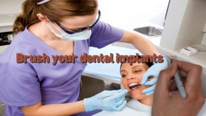5 Things that You Should Know before Getting Dental Implants-408-335-6637