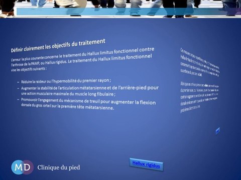 L’utilisation d’orthèses plantaires pour les douleurs du pied causées par un Hallux rigidus