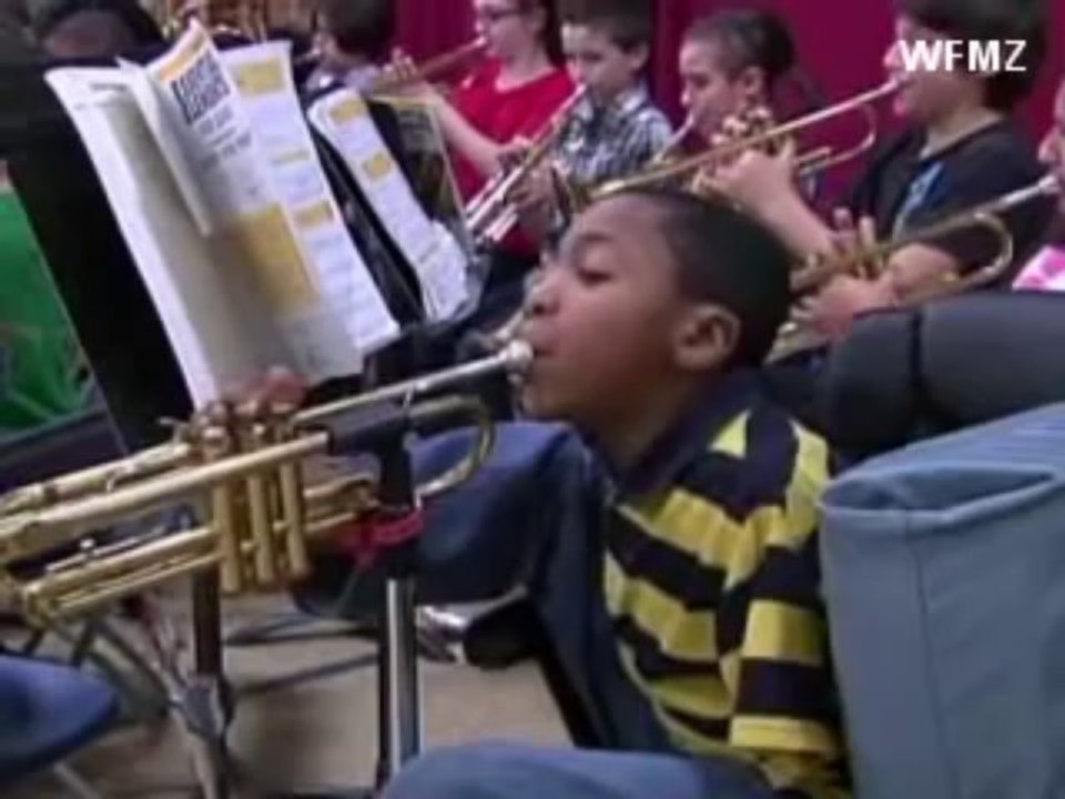 Boy With No Arms Plays The Trumpet!!