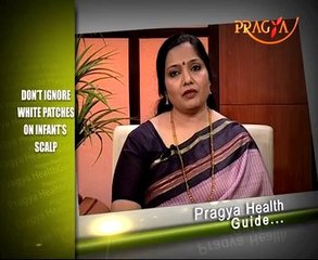 Don't Ignore White Patches on Infant's Scalp by Dr.Vibha Sharma .