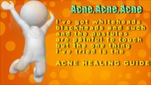 Acne Treatments | Skin Conditions | Diseases | Remedies | Pimples
