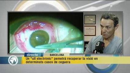 TV3 - Els Matins - Un "ull electrònic" pemetrà recuperar la visió en alguns casos de ceguera