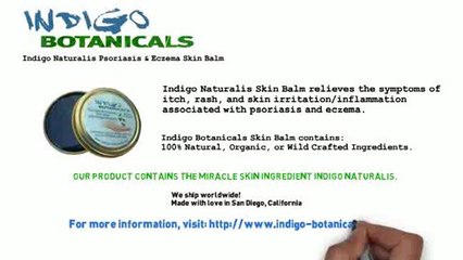 How To Treat Psoriasis Naturally